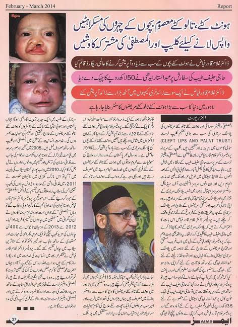 Free Plastic Surgery of Cleft Lip and Cleft Palate in Lahore