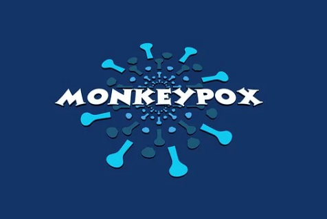 Monkeypox Symptoms, Causes, Diagnosis, Prevention & Treatment (Urdu & English)