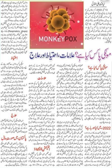 Monkeypox Symptoms, Causes, Diagnosis, Prevention & Treatment (Urdu & English)